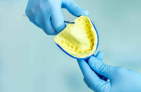 変形が少ないシリコーン印象材料を使用