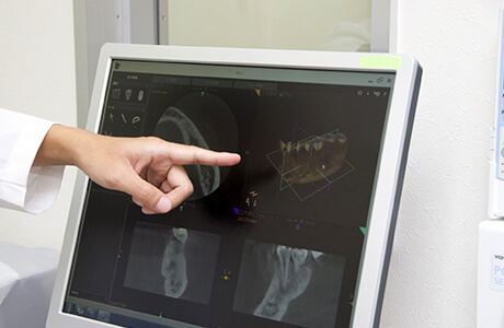 X線装置の使用