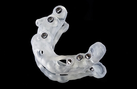 専属技工士との連携した治療