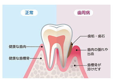 患者様ご自身で行うセルフケアのポイント