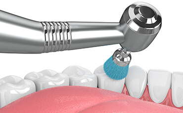 STEP2 クリーニング