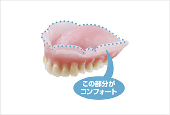 ​​コンフォート義歯​